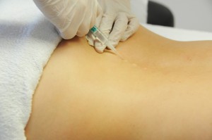 Neuraltherapie 3